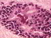 Rabies Virus - Bat Infestation